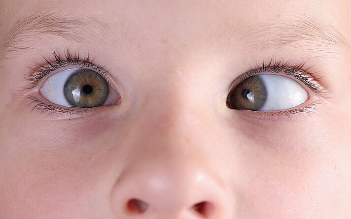 Child's face with squint and freckles on nose.